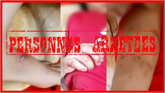 الدار البيضاء.. توقيف أم وشريكها بتهمة تعنيف وحرق طفلة وتفعيل بروتوكول حماية الضحايا